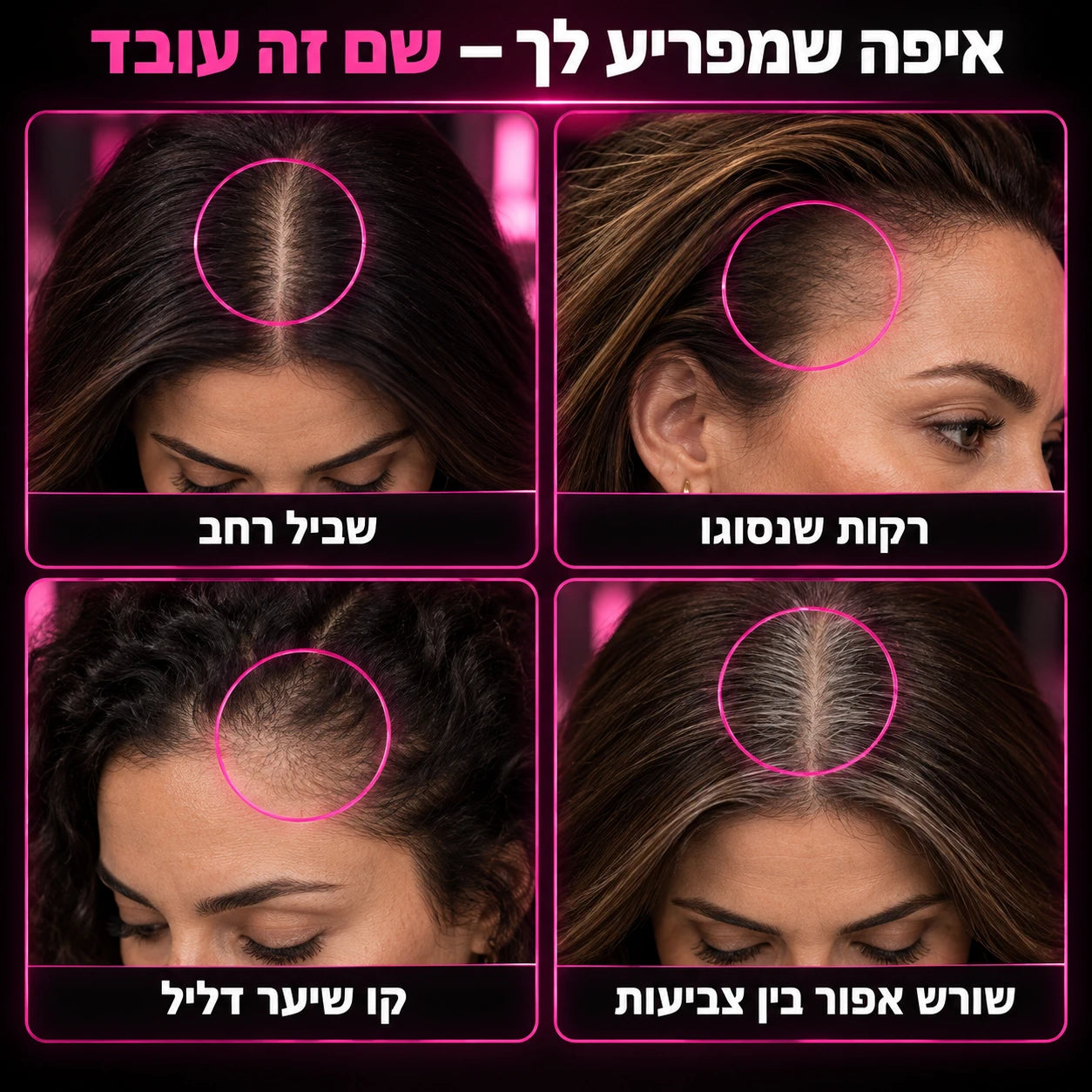 ארבעה אזורי שימוש: רקות, שביל, שורש אפור וקו שיער