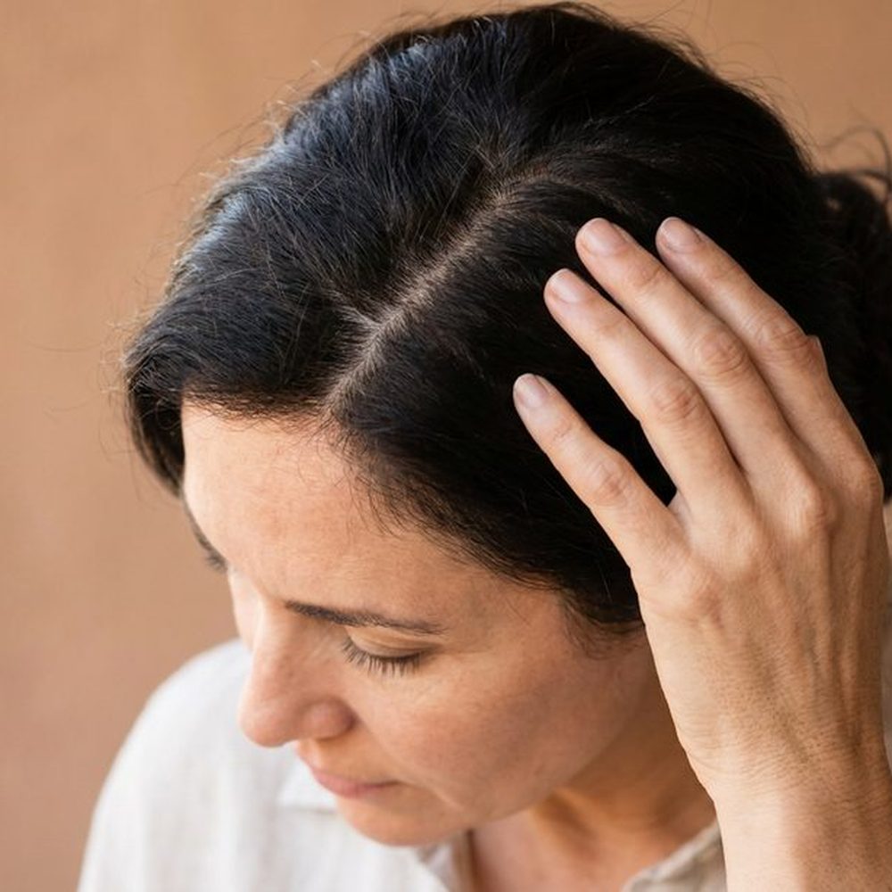 שיער דליל וקרקפת